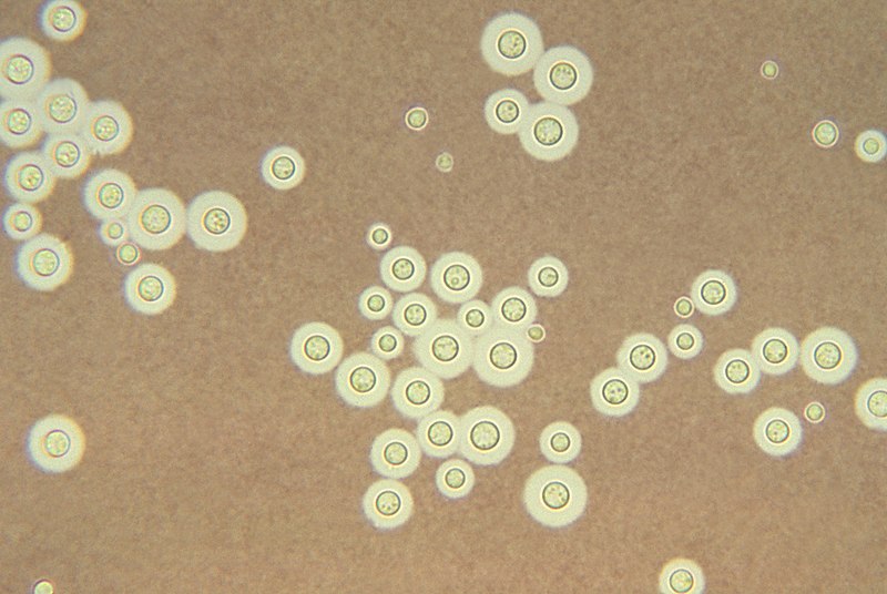 800px-Cryptococcus_neoformans_using_a_light_India_ink_staining_preparation_PHIL_3771_lores.jpg