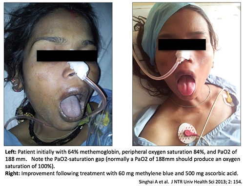 emcrit.org
